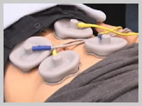 ���^�{���b�N�΍�ɂ̓e�N�g����